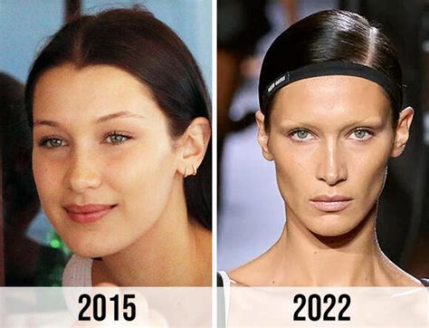 bella hadid buccal fat removal|Buccal fat removal: what is it and why is everyone。